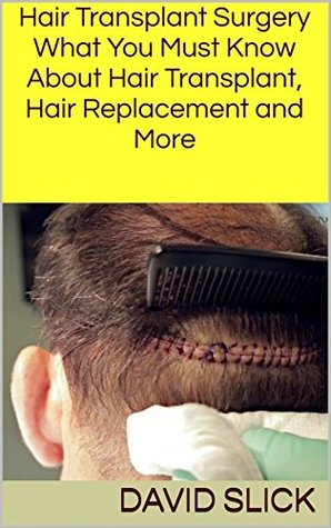 [161c7] ~Download^ Hair Transplant Surgery: What You Must Know About Hair Transplant, Hair Replacement and More - David Slick *e.P.u.b*